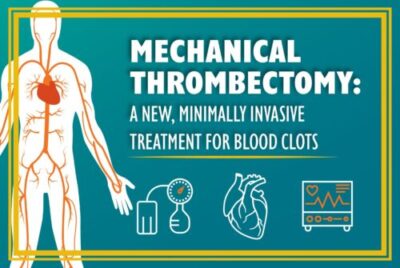 Grey Topics in Thrombectomy era